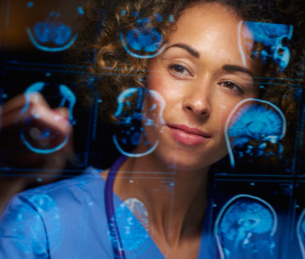 Doctor viewing brain scan